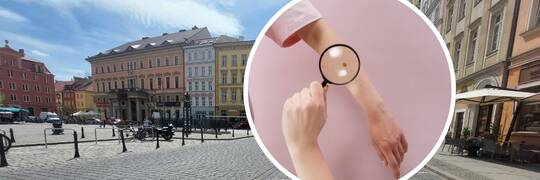 Lekarze wyjdą na pl. Solny. Można będzie zbadać tu niepokojące znamiona na skórze