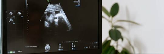 Wrocław kontynuuje program „OD-ŻYJ”. To pomoc mamom dzieci z wadami rozwojowymi